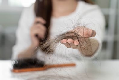 MDZol | Sigue estos siete pasos para detener la caída de cabello y la aparición de canas Foto: Shutterstock