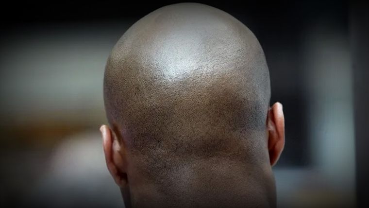 La práctica ya se ha dado en este país. Foto: Minuto30.