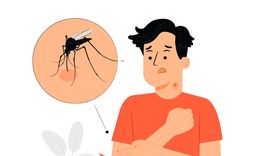 El sistema inmunológico de cada persona reacciona de forma diferente a las picaduras de insectos, lo que produce síntomas únicos en cada víctima, desde hinchazón hasta picazón y dolor. Foto: Freepik