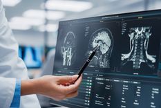 El ACV es la segunda o tercera causa de muerte a nivel mundial y es la primera causa de discapacidad en mayores de 18 años