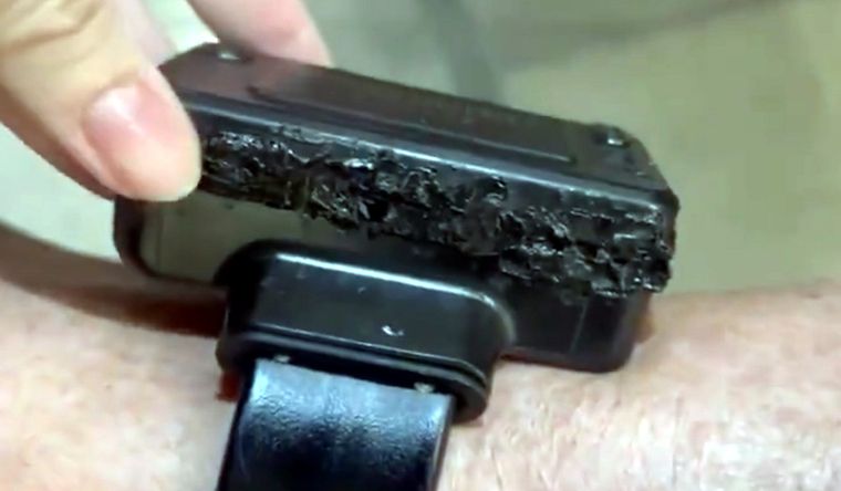 La tobillera dañada de Jair Bolsonaro, detenido en Brasil. Foto Dpa La tobillera dañada de Jair Bolsonaro, detenido en Brasil. Foto Dpa