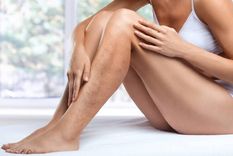 Cómo mejorar la circulación sanguínea en las piernas (Shutterstock). Foto: Archivo