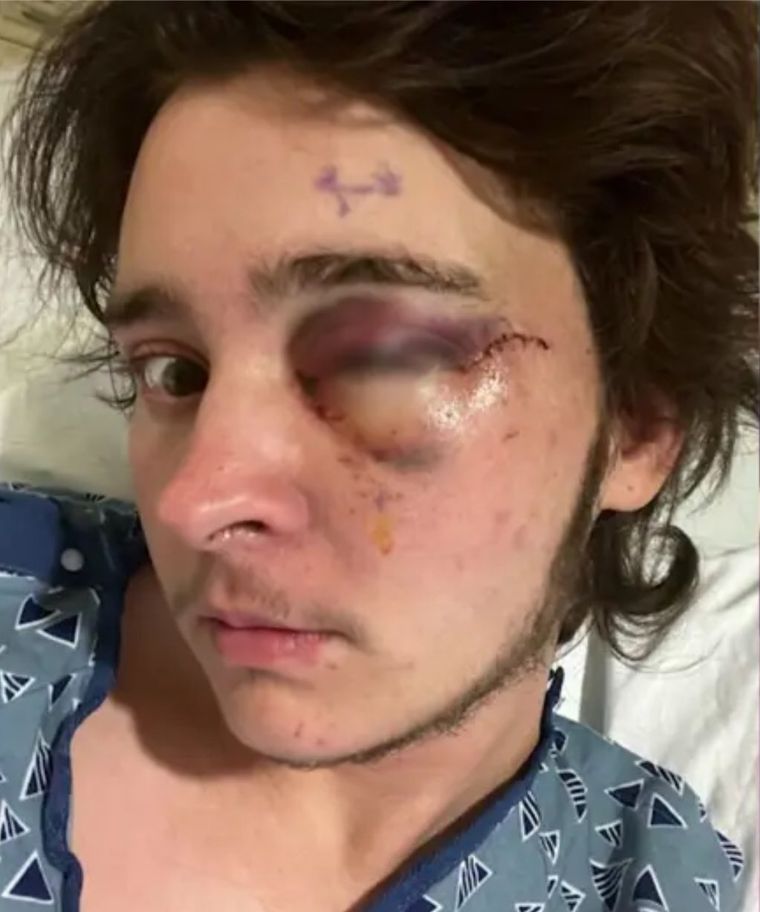El joven manifestante que fue baleado durante una protesta contra ICE en California. El joven manifestante que fue baleado durante una protesta contra ICE en California.