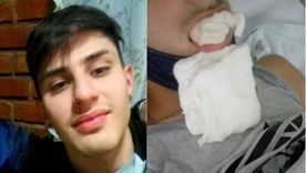 Facundo lleva 20 días esperando para que le coloquen cuatro placas de titanio tras un violento ataque en San Martín