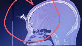 El agresor le clavó una llave de auto en la cabeza a un exfutbolista y padre de una jugadora en un torneo sub 16 en Berazategui. El agresor le clavó una llave de auto en la cabeza a un exfutbolista y padre de una jugadora en un torneo sub 16 en Berazategui.
