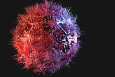 MDZol | El paciente fue diagnosticado con VIH en los años 80. Foto: GETTY IMAGES