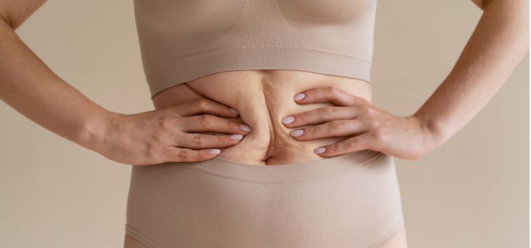 Los ejercicios abdominales, en la mayoría de los casos no resultan suficientes para devolver la tonicidad. Los ejercicios abdominales, en la mayoría de los casos no resultan suficientes para devolver la tonicidad.