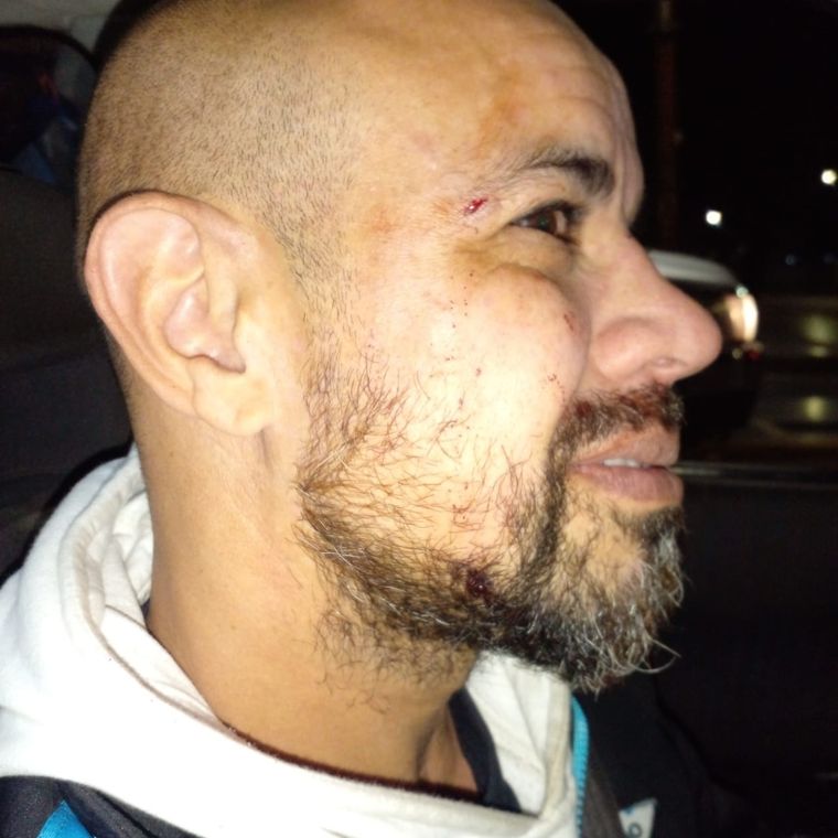 El entrenador de arqueras de Argentino fue salvajemente agredido. Foto: Gentileza