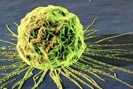Anuncian avances para detectar cáncer de mama con prueba de sangre
