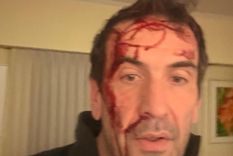 El candidato a senador por LLA fue brutalmente atacado a horas de las elecciones.