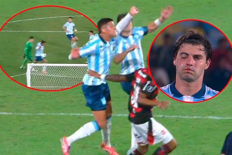 Marcos Rojo tuvo un accidentado final de partido. Marcos Rojo tuvo un accidentado final de partido.