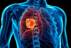 El avance sería una revolución en la lucha contra una enfermedad que lleva décadas Foto: Archivo El avance sería una revolución en la lucha contra una enfermedad que lleva décadas Foto: Archivo