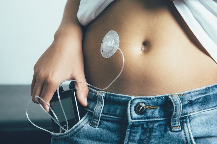 La tecnología es una aliada para el control de la diabetes. Foto: Shutterstock