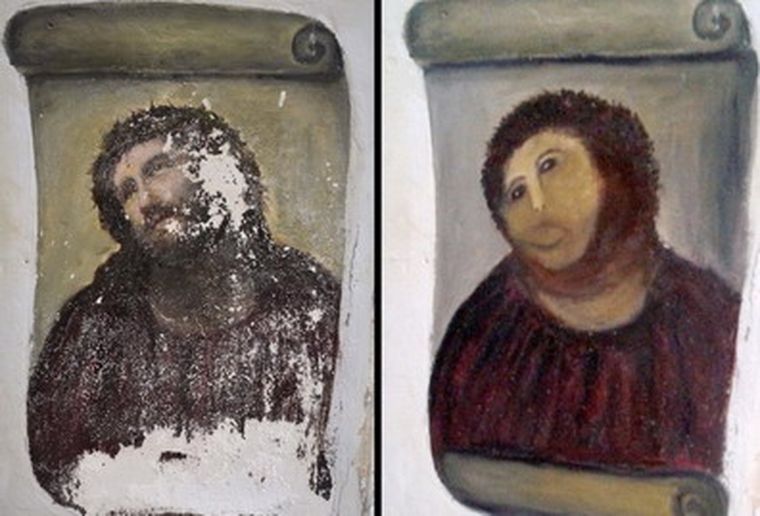 El antes y el después de la mano de Cecilia.