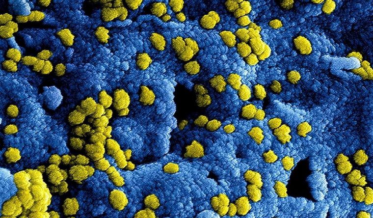 Imagen digital del coronavirus Mers, que tiene atenta a la Organización Mundial de la Salud. Foto Dpa Imagen digital del coronavirus Mers, que tiene atenta a la Organización Mundial de la Salud. Foto Dpa