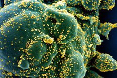 el covid-19 podria atacar las celulas del sistema inmunitario como el vih