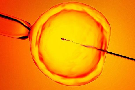 la tecnica que ayuda a encontrar espermatozoides ocultos y ofrece esperanza a hombres con infertilidad la tecnica que ayuda a encontrar espermatozoides ocultos y ofrece esperanza a hombres con infertilidad