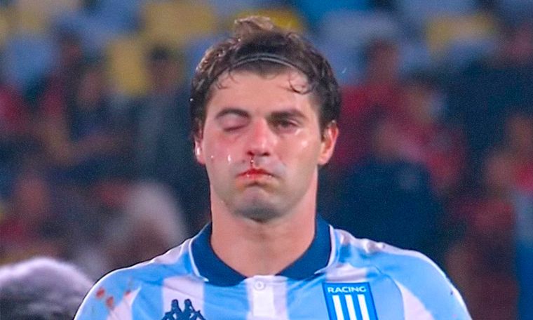 Así le quedó la cara a Sosa tras el codazo de Rojo. Así le quedó la cara a Sosa tras el codazo de Rojo.