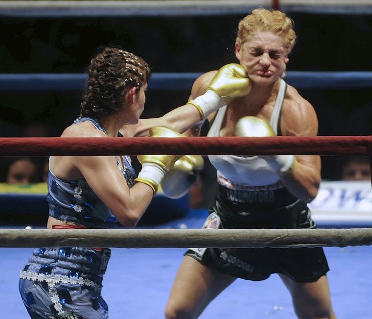 Mientras Alejandra Locomotora Oliveras&nbsp; permanece en terapia intensiva, las redes se llenan de mensajes alentándola: Esta es la pelea de tu vida, y la vas a ganar como siempre. Foto NA