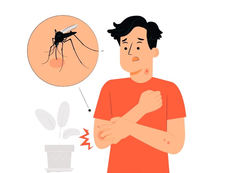 El sistema inmunológico de cada persona reacciona de forma diferente a las picaduras de insectos, lo que produce síntomas únicos en cada víctima, desde hinchazón hasta picazón y dolor. Foto: Freepik