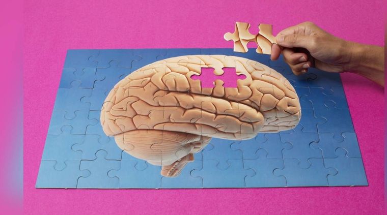 El cerebro registra actividad, aun con el corazón detenido. Foto: Semana.