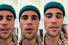 justin bieber confeso que sufre paralisis en la mitad de su rostro