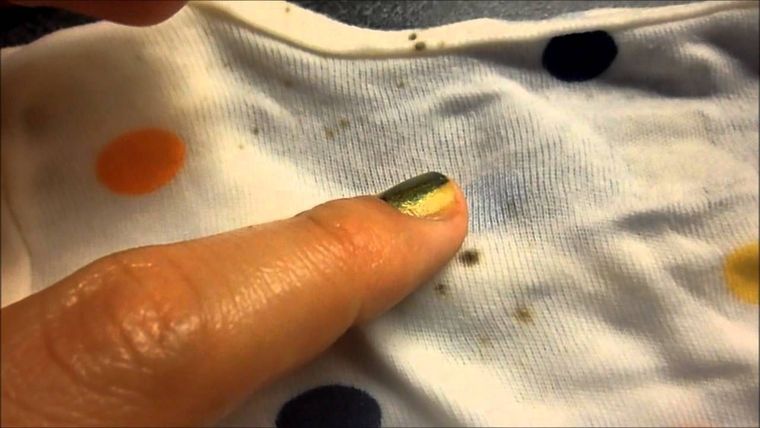 La humedad en los armarios puede provocar que nuestra ropa se estropee con moho. Foto: Pinterest