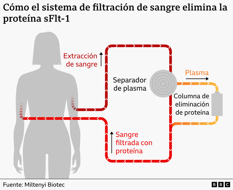 https://www.bbc.com/mundo/articles/cr7pjk4j2ejo