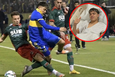 boca: difunden foto de como le quedo el tobillo a zeballos tras el patadon de leyendeker boca: difunden foto de como le quedo el tobillo a zeballos tras el patadon de leyendeker