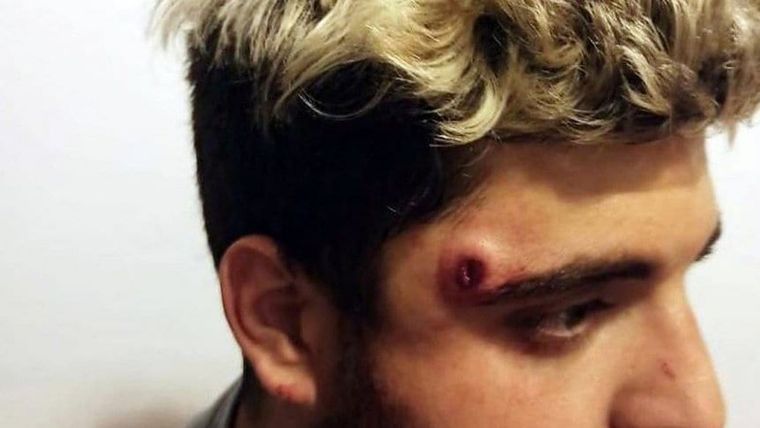 Herida Los médicos le extrajeron la bala y el chico está bien