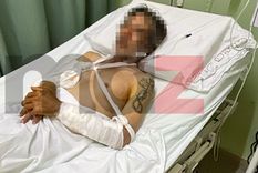 El changarín herido por los pitbulls en Las Heras.