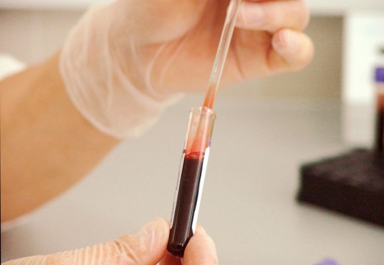 Un estudio sobre el sistema inmunológico de las personas con depresión abre el camino para diagnosticar la enfermedad a través de la sangre. Foto: Conicet