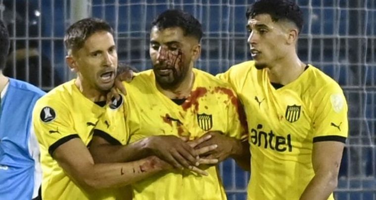 Se conoció la sanción para Central por la agresión a un futbolista de Peñarol Foto: Captura