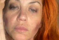 Lourdes de Bandana denunció ser víctima de violencia de género Lourdes de Bandana denunció ser víctima de violencia de género