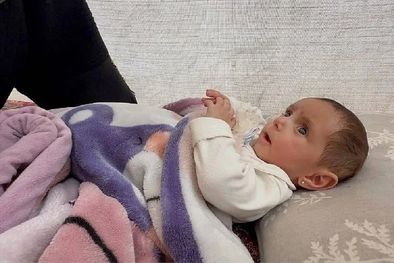 MDZol | Niveen tiene 7 meses y nació con un agujero en el corazón. Foto: BBC