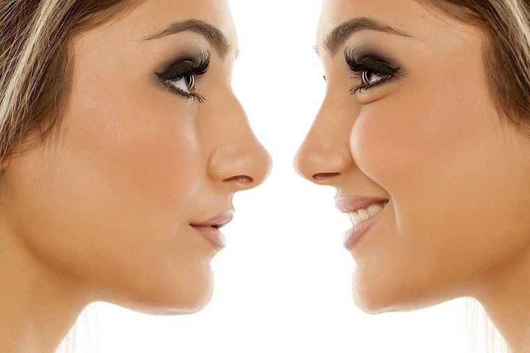 Se trata de una técnica para mejorar el rostro sin caer en la cirugía. Foto: expobeautymagazine.com