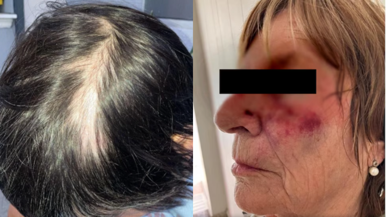 La mujer y su madre realizaron la denuncia tras el ataque en Mar del Plata.