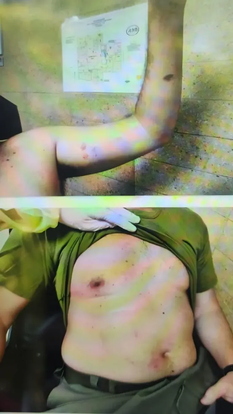 Así quedó el gendarme herido Así quedó el gendarme herido