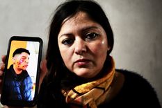 La mamá de Ignacio muestra como la policía le dejó el rostro a su hijo La mamá de Ignacio muestra como la policía le dejó el rostro a su hijo