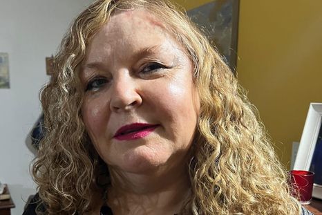 Marisa Giordano comparte su historia y cuenta cómo es vivir con trastorno bipolar.&nbsp;