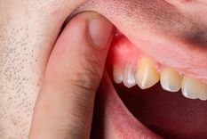 Estos remedios naturales son antiinflamatorios. Foto: Archivo