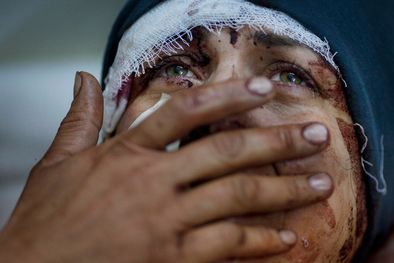 MDZol | Foto: AP / Rodrigo Abd