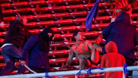 Un hincha chileno totalmente ensangrentado en la tribuna sur alta del Libertadores de América. Un hincha chileno totalmente ensangrentado en la tribuna sur alta del Libertadores de América.