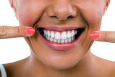 sonrisas perfectas: el nuevo universo de las carillas dentales