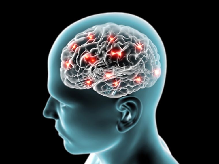 Ocho de cada 10 accidentes cerebrovasculares pueden prevenirse