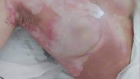 Así quedó la joven tras ser atacada por su pareja