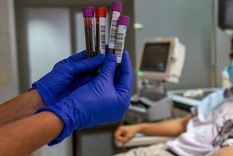 Las células con cáncer llegan al cerebro y algunas forman metástasis. Foto: Efe Las células con cáncer llegan al cerebro y algunas forman metástasis. Foto: Efe