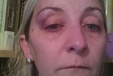 brutal golpiza a ex mujer de ottavis que se quejo de que vio al papa brutal golpiza a ex mujer de ottavis que se quejo de que vio al papa