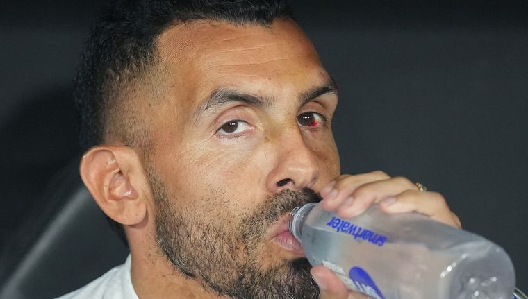 Carlos Tevez fue duro tras la derrota. Foto: NA