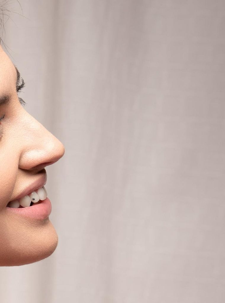 Antes de realizar un cambio estético en las piezas dentales es fundamental consultar con especialistas Foto: Gentileza